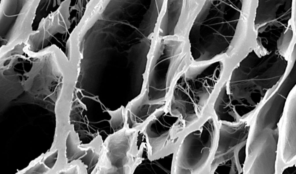Jason® membrane