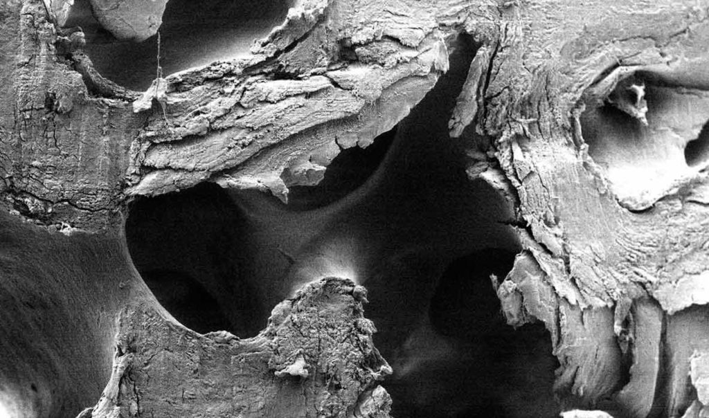 maxgraft®